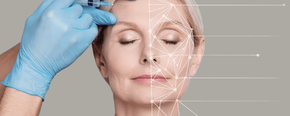 white woman with lines over her face higlighting the areas she might need dermal filler treatment