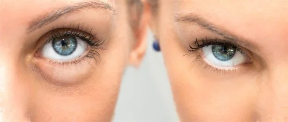 Close up of two women's eyes