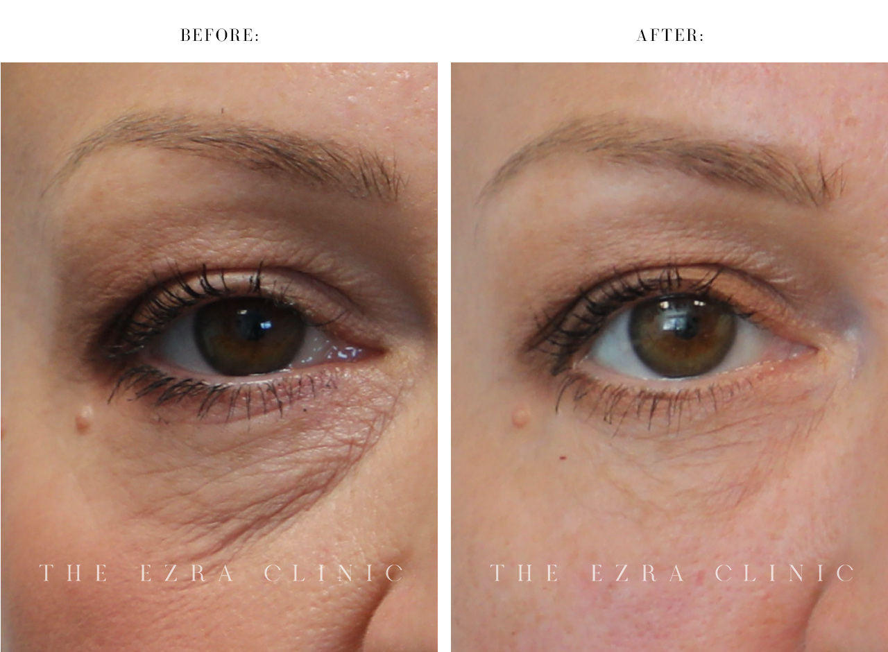 The-Ezra-Clinic_Before-After_WHITE_01