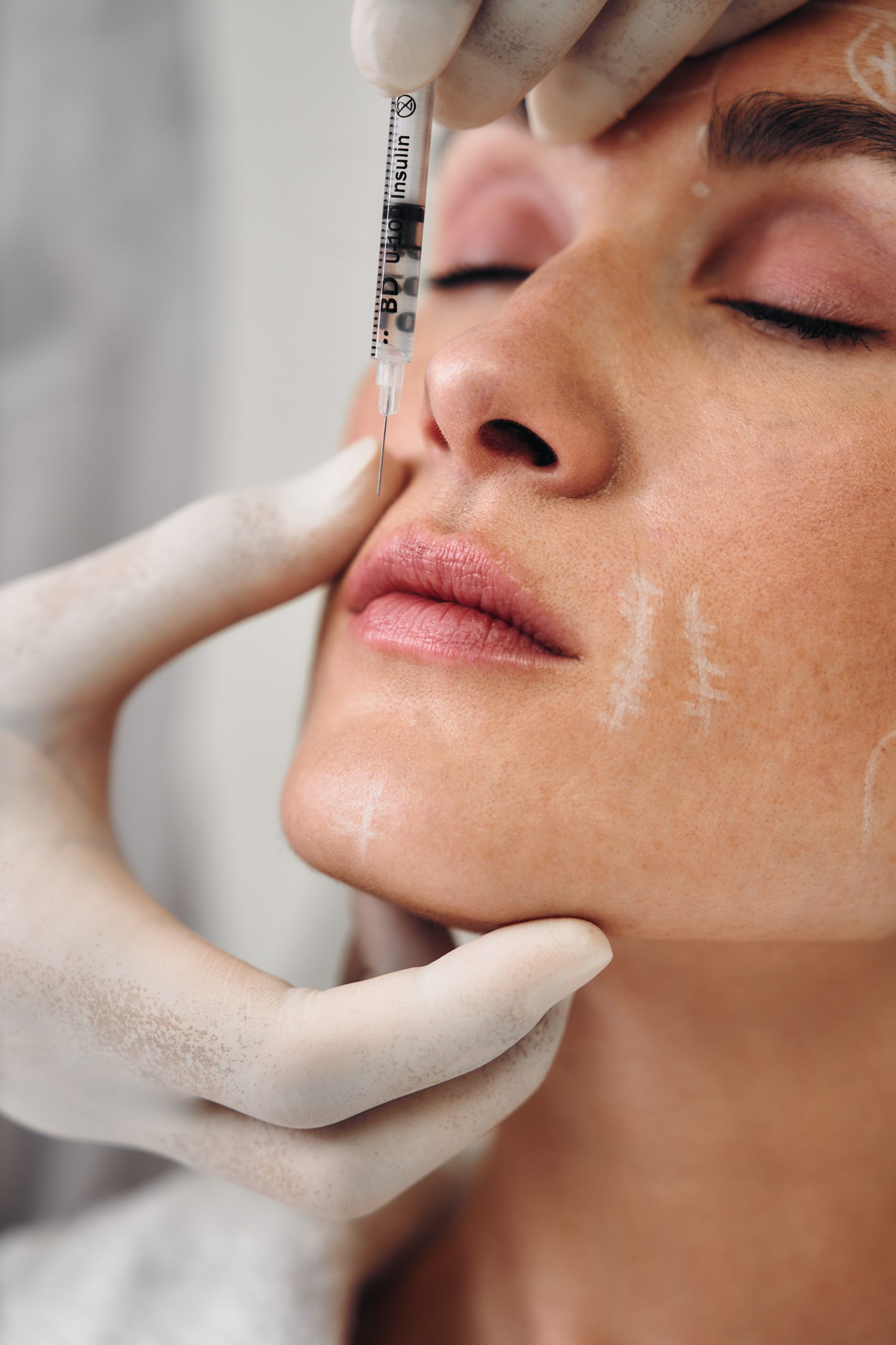 Contour modeling with fillers.