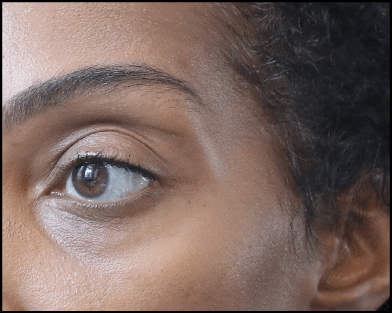 Photo of a woman's face after temple filler