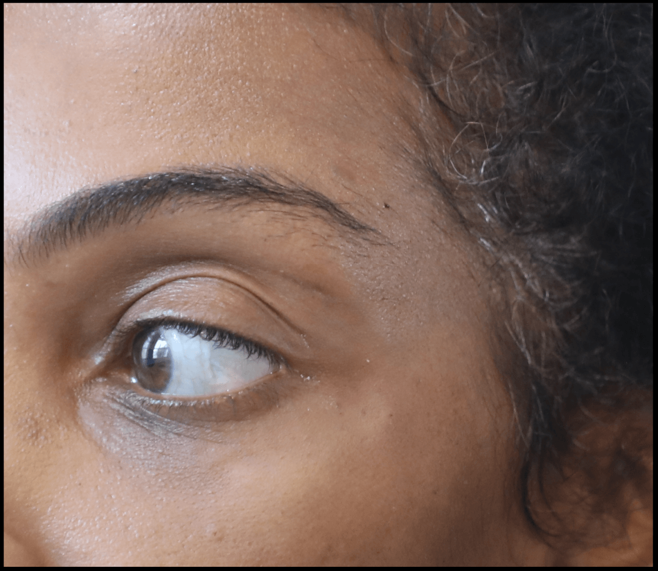 Photo of a woman's face before temple filler