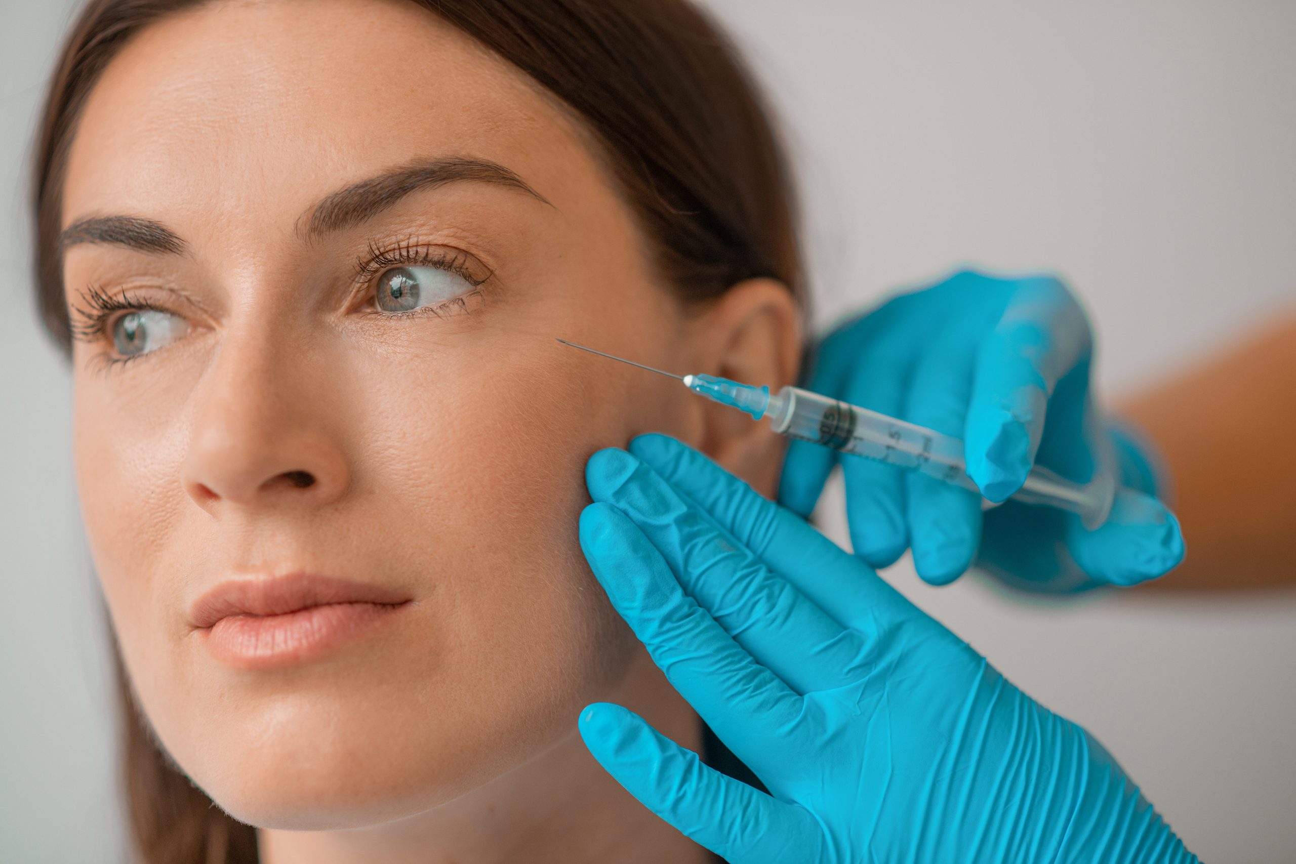 A dark-haired woman having temple filler treatment