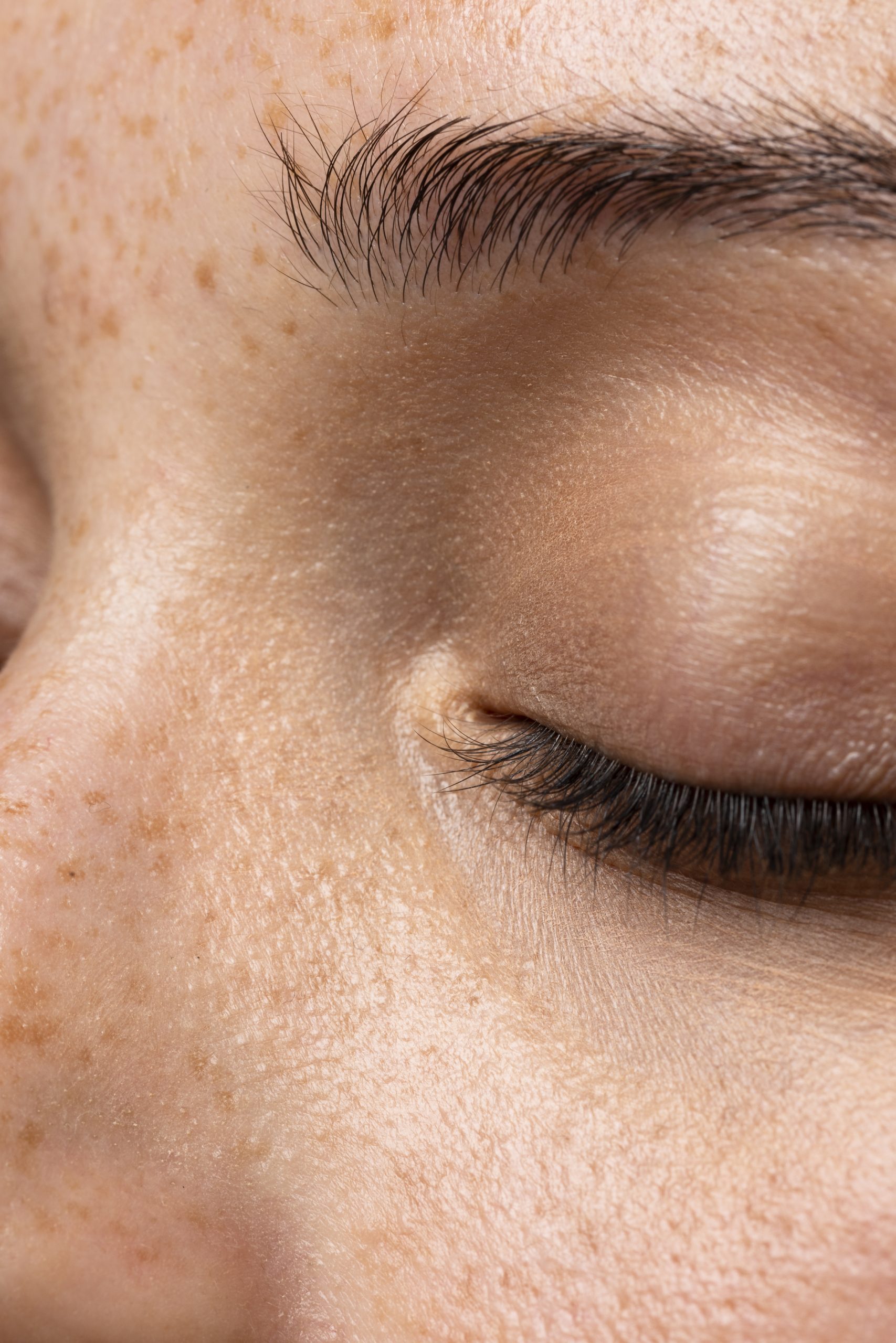 Close-up of a closed eye showing natural skin texture, freckles, and eyelashes.
