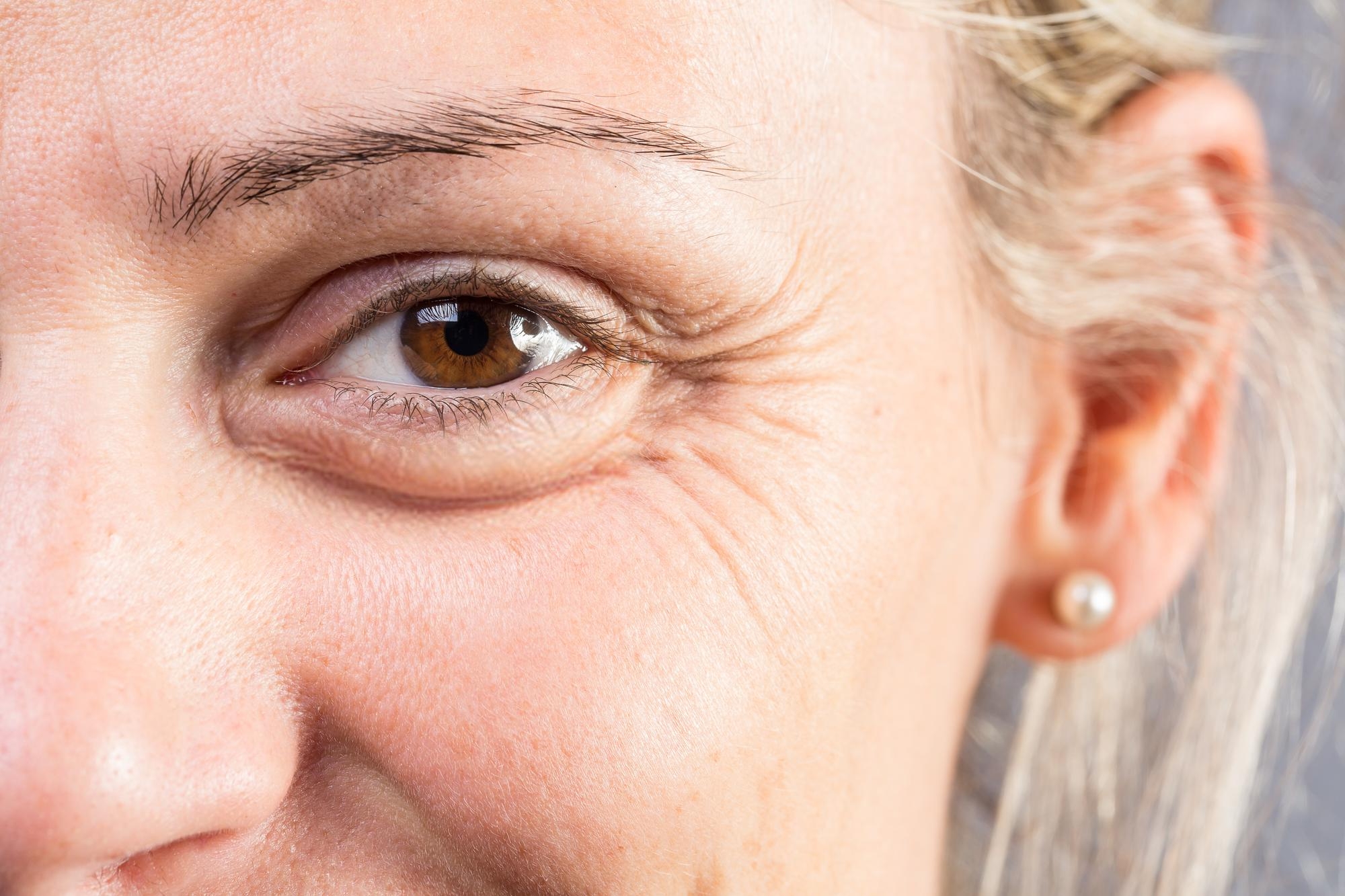 Close-up of a mature woman’s eye showing natural wrinkles and skin texture in soft lighting.