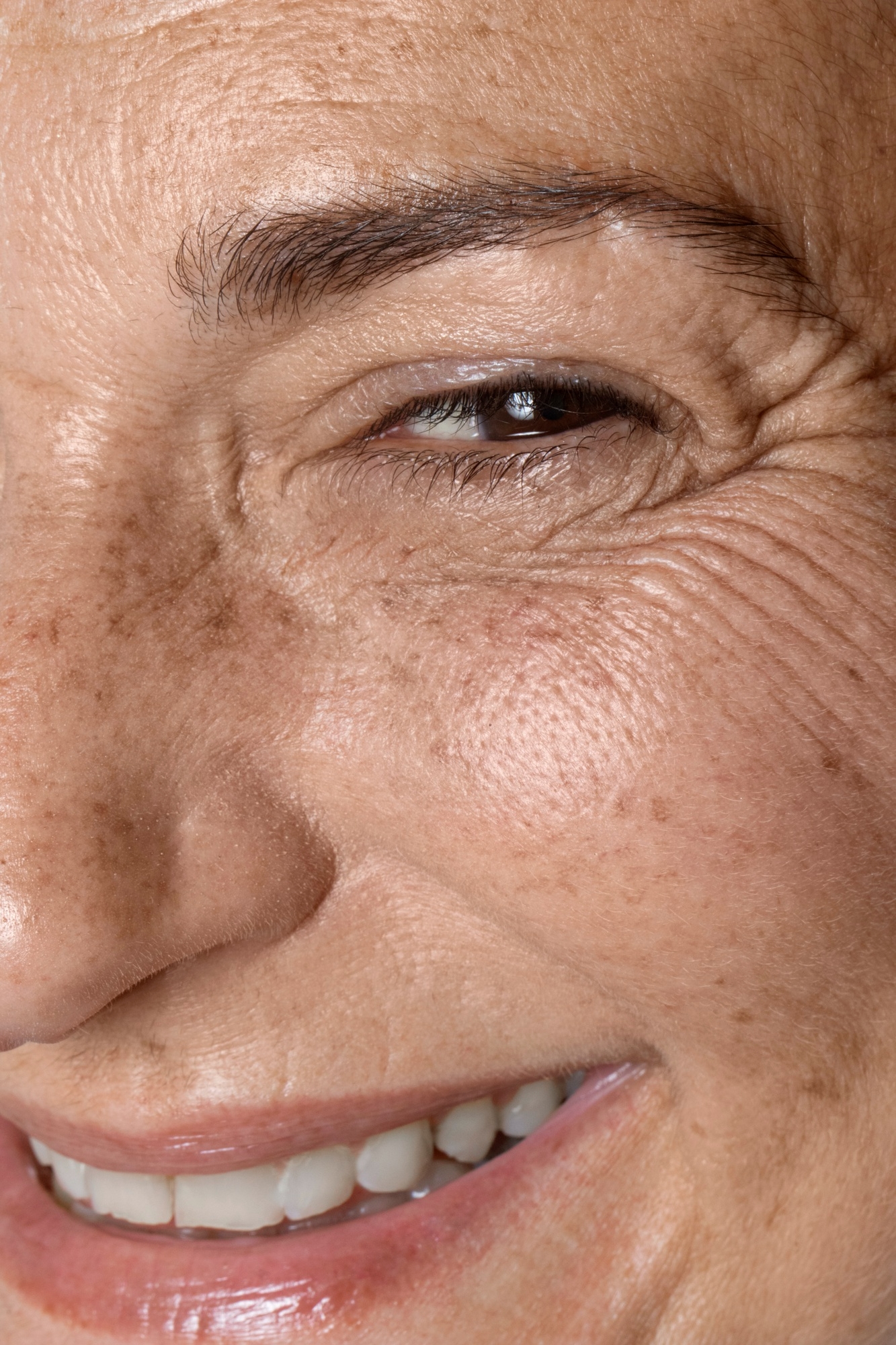 Close-up of a smiling person’s face showing fine lines and crow’s-feet around one eye.