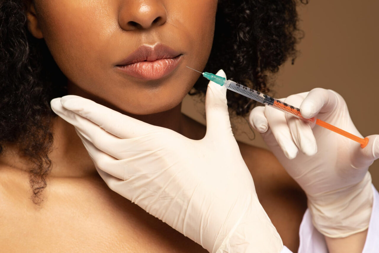 Close-up of a cosmetic professional preparing to inject dermal filler into a woman’s lips using a syringe.