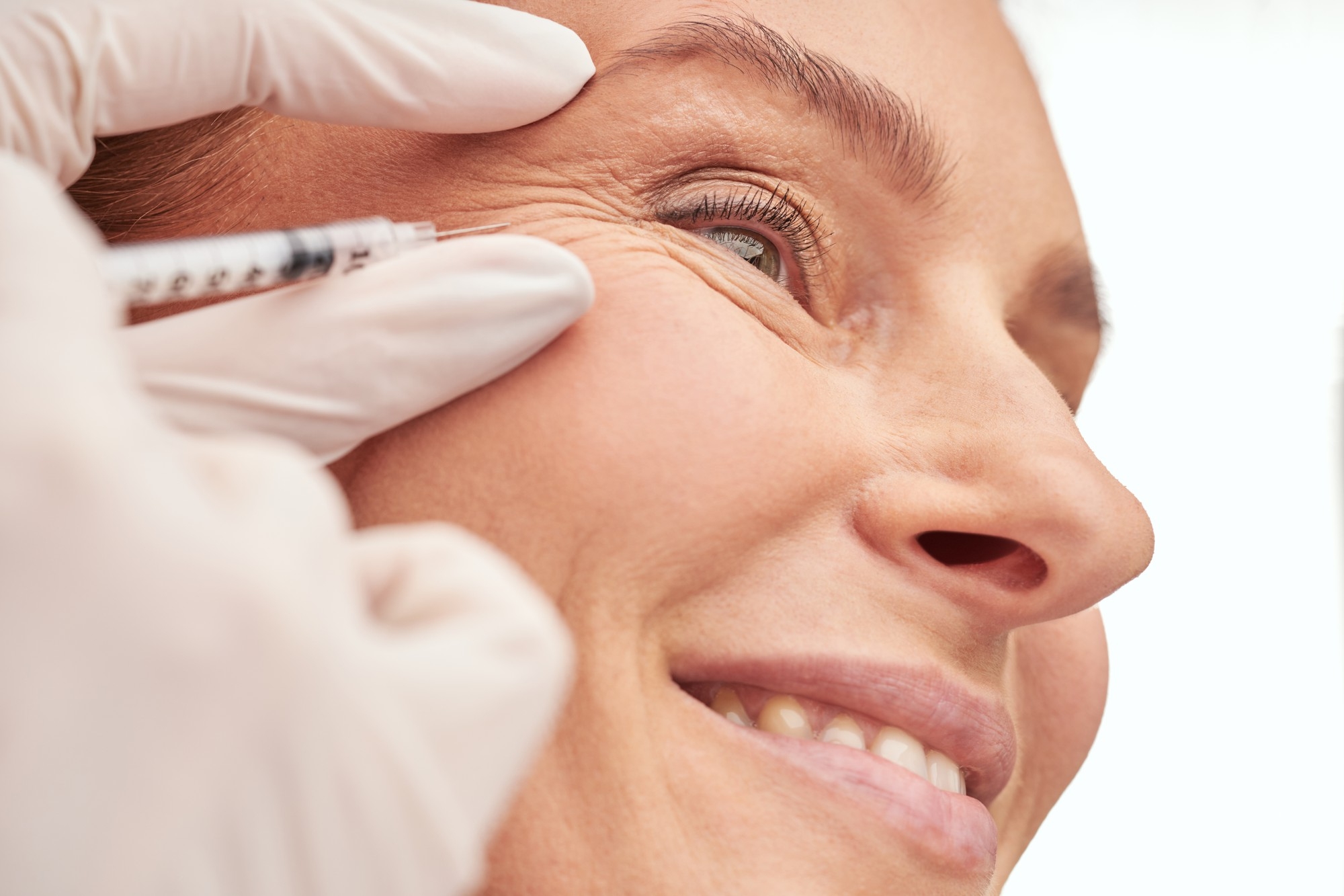 Close-up of a woman smiling while a gloved hand holds a syringe near the outer corner of her eye.
