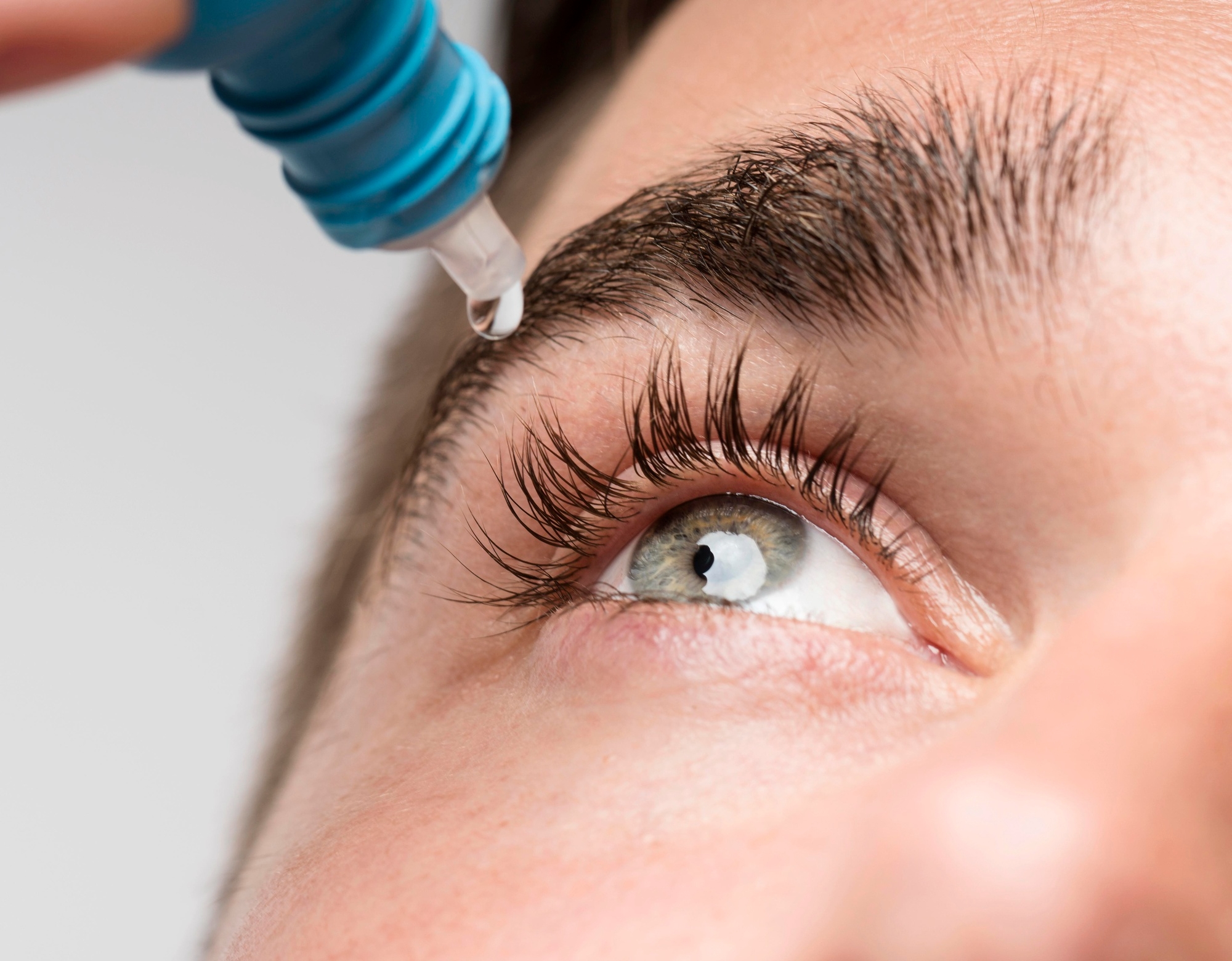 Close-up of eye drops being applied to a woman's open eye from a blue dropper bottle