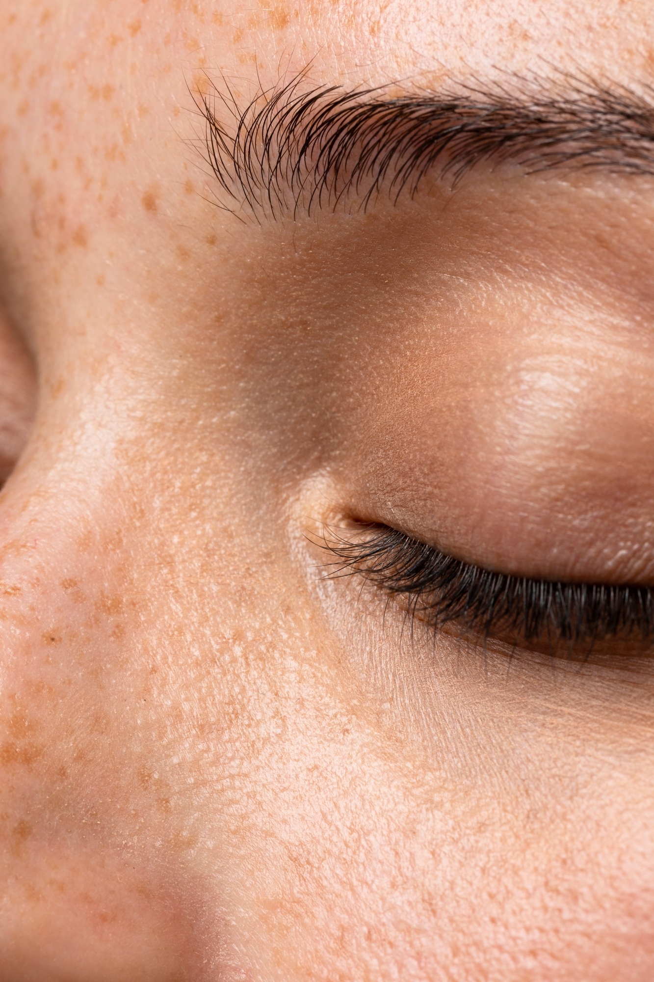 Extreme close-up of a closed eye showing freckles and sun pigmentation on the surrounding skin
