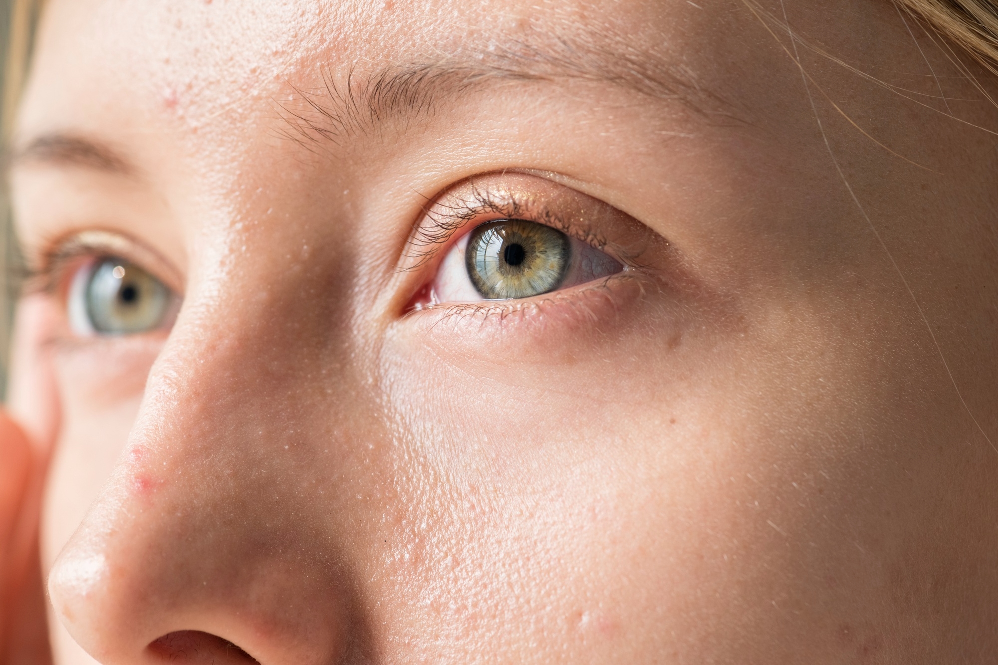 Close-up of a young woman's green eyes and natural skin texture in bright daylight